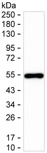 NPTX1